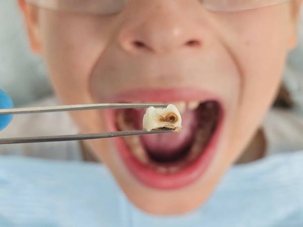 Best Pediatric Emergency Dentist in Altamont, KS